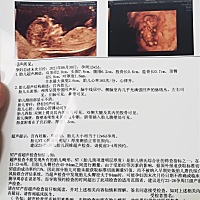 各位妈妈们，麻烦看下是男孩还是女孩，第一胎是男孩，第二胎想要一个小公主