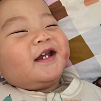 下面的牙比V，长了3颗，上面长了1颗，是啥原因呢