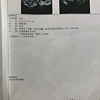 大家帮我看看女宝宝，还是男宝宝