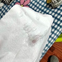 这是不是说明排卵 了呢