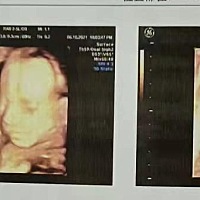 四维照片能看出男女宝吗？麻烦大家帮忙看看哈