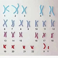 临床研究将胚胎染色体异常原因归于以下几类： 1、大龄生育，减数分裂异常导致染色体不分离； 2、辐射，...