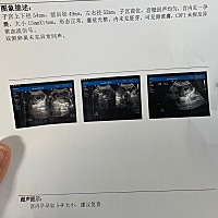 已经生了两个孩子真的不想再生第三胎了，无奈，措施没做好还是怀了第三个，对生孩子这件事恐惧极了，对...