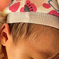 这个是捂热了的痱子吗？还是湿疹之类的呀
