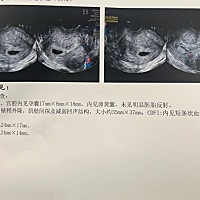 已知男宝姐妹们恭喜我吧！大家接好运！