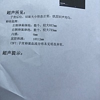 不懂得看是不是排卵了？有一样的吗？