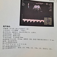 今天去产检，有会看男宝女宝的朋友吗？求告知！