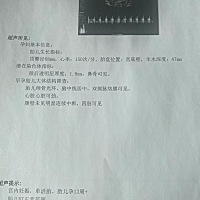 期待你的到来