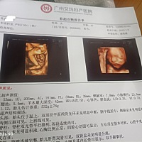 宝妈们帮我看看这是男宝宝还是女宝宝，做了差不多两个小时小宝宝一直趴着，医生叫我爬楼梯背着我家大宝...