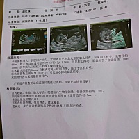 二胎，希望是个男宝宝，有没有会看的，说说呗