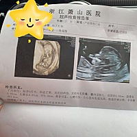 是个男宝还是女宝呀 非常好奇