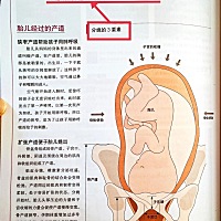 🔥接顺产无侧切无撕裂！无痛分娩vs剖腹产 如果各方面条件都可以，能顺就尽量别剖，当然一切遵医嘱‼️...