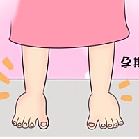 怀孕期间，不少准妈妈都会经历水肿，一般出现在脚踝、脚背、手部、小腿等部位。这是因为孕期激素水平发...