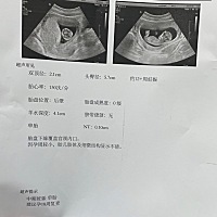 请各位宝妈帮忙看看是男宝还是女宝♥️谢谢啦