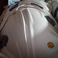 看这肚子大的很，我以为怀孕了。