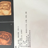 这个能看出男孩女孩宝宝么？