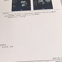 次末月经是8.1号开始的,9.26号B超检查已孕50 大概是什么时候受孕的