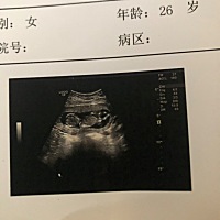 有没有看懂单子上是男孩还是女孩的帮一下忙