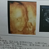 宝宝 妈妈的奶已经涨得发痛了  多希望你能吸两口 都没来得及吃一口妈妈的奶就走了 妈妈每天都在想你 我...