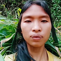 有没有宝妈剖腹产三胎的，