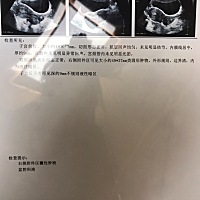 医生让过两天抽个血 有点担心