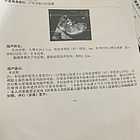 有会看的吗？男宝女宝