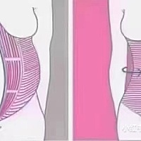 🧘‍♀️ 腹肌直‬分离知识分享 ①：轻分度‬离：1.5指宽 ②：中分度‬离：1.5—2.5指宽 ③：重分度‬...