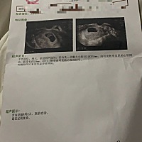 还记得22.09.18日，8 3第一次见红，担心和害怕，当晚立马住院保胎，各种检查，吃药，打针，卧床￼，由于...