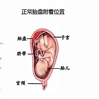 问:前壁胎盘和前置胎盘是同一个意思吗？ 答:不是。 虽然只差一个字，但两者意义完全不同：前壁胎盘属于...
