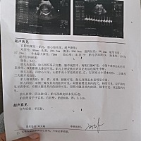 怀老大的时候我就有预感是个女孩，生下来真的是女孩，二胎虽然我想要生儿子，但是我预感还是女孩，不知...