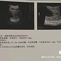姐妹们先帮忙算下，今天抽血了，4天后回来告诉您们结果