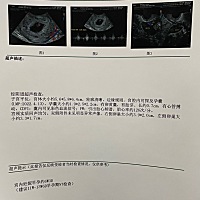 六周三天，孕酮从半个月前的22降到15了，是不是有点低呀？好担心，还有孕囊怎么看大小呢姐妹们？