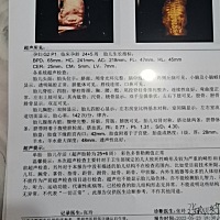 懂得帮忙看一哈，谢谢。