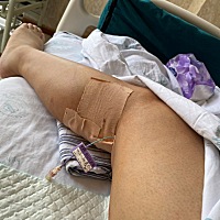 奉劝各位妈妈们生了娃的，月子里一定要多活动！特别是剖腹产！我两个娃都是剖腹产，这是第二个，坐了一...