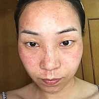 孕期最心酸的就是长斑，现在也终于轮到我晒自拍🤳了，希望大家都美美哒☺️