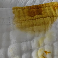 请教宝妈们一下宝宝拉的便便正常吗