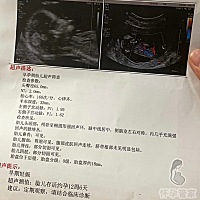 nt做了半个小时，医生要照的时候宝宝就开始动了，不知道是男宝女宝