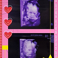 第一次见到小二宝的模样，和哥哥还是很像的。