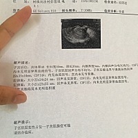 从15岁开始疼，今年30还在疼，子宫内膜异位症