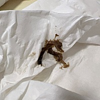 排卵期黑色分泌物，是子宫内膜吗