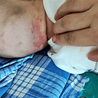 家人们有谁知道抱抱脑袋后面，靠近脖颈这红色的是啥？摸起来是光滑的，希望知道的家人们帮忙告诉一下，...