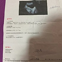 姐妹帮忙看一下是不是怀孕了