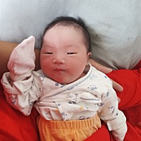 这个胎记长得好