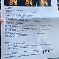 这是去医院最快的一次，还带了糖和饼干，就怕和一胎一样从早做到下午，感觉和一胎不怎么像