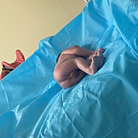 每位妈妈都太伟大太不容易了！一关闯完又一关！宝宝出生两天了、顺产无侧切！感谢无痛，更感谢专业有耐...