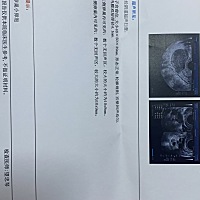促排一个星期左右，泡泡长到18/8，在打三天在做B超复查