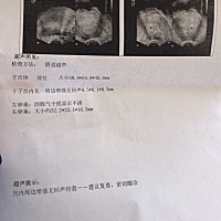 末次月经是9月25日来的，10月13日同房，昨天去检查，医生看了结果说挺好的，让三天后再去复查有没有翻倍...