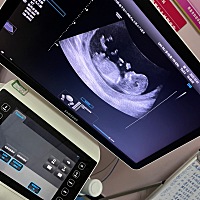 记录📝我的小汤圆