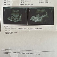 懂得姐妹给看看是男孩还是女孩