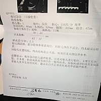 半夜两点感觉破羊水流水了，到了医院人家说没破，就做了个必超